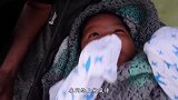 世界上最黑的小宝宝，如今5岁了，长大后的成这样
