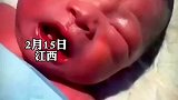 宝宝刚出生便有牙齿，婆婆说对老人不好，天天吵着要把宝宝送人