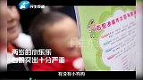 揪心！眼球凸出严重快破裂，两岁小娃娃被喊“小怪兽”