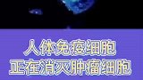 免疫细胞消灭肿瘤细胞过程，像是水火星球打架，一时都分不清敌友