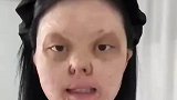 一岁半烧伤的女孩自信妆教，这才是化妆的意义