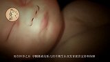 孕期孕酮低怎么办孕妈先别急，这两种水果或许能够帮到你