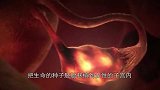 女性做试管婴儿有多疼？3D模拟全过程，看完心疼女人！