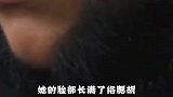 16岁女孩患有怪病，脸上胡子比男生多，网友：女版李逵