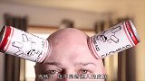 外国小哥皮肤真特别，不仅可以吸附物体，而且伤口愈合速度快