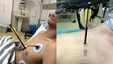 疼！男子在家玩弩箭竟射中自己心口 离心脏仅1厘米