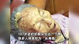 107岁老奶奶额头生出长寿角，已长好几年了，曾孙透露老人心态好、胃口也好