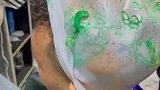 小伙子漂染的搞笑绿色卷毛！