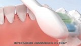 电动牙刷到底好在哪儿3D动画演示，怪不得价钱是普通牙刷的几倍