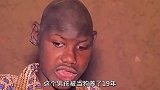 男孩被锁19年，由于智商缺陷导致精神异常