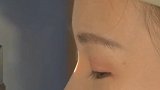 湖北女白领眼睛干痒还掉睫毛 竟是卸妆不彻底螨虫寄居