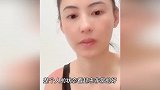 养孩子不容易！张柏芝为卖货故意晒伤自己，肩膀又红又肿看着就疼