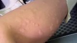 夏天已来临，户外一定要做好防护