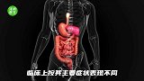 请珍惜生命，远离毒蘑菇！科普 急救 安全 健康科普 急救技能 蘑菇 毒蘑菇 采蘑菇 健康