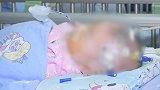 湖南：盖3层被子穿3件衣服，两月宝宝捂出病进重症室