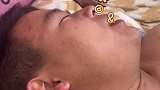 男子发烧40度说胡话，语速飞快神似外语