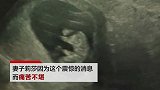 准爸爸看到胎儿B超图太兴奋 几小时后脑溢血死亡