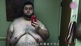 励志27岁小哥成功减282斤，切除的松弛皮肤有近12斤