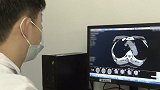 女子颈部长“包”反复疼痛 “元凶”竟是10个月前的一根鱼刺