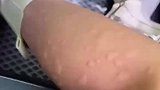 这是捅了蚊子窝吗，都数不过来