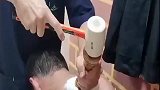 祖传中医正骨，有试过的吗