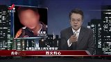 传奇：小孩全身严重烧伤，真凶身份让人难以置信，孩子太可怜了