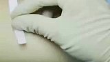 伤口自动愈合？国外发明拉链式创口贴，无需缝针，轻轻一拉！
