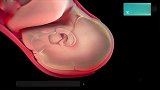 3D动画演示：胎儿脑袋这么大，产道这么小，宝宝到底怎么顺产的