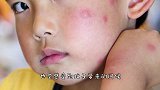 蚊子在地球上到底有什么用？如果把蚊子全部消灭，会有怎样的后果