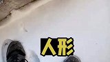 男子晒自己昨天的摔倒形状逗笑网友