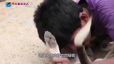 世界上最脆弱的男孩，全身石化皮肤一碰就碎，医生看了直摇头