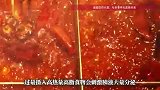男子连吃3天火锅猪蹄患急性胰腺炎，医生回应