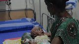 印度自燃男孩，出生3个月就自燃4次，专家看了都没法理解