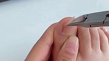 有了这个鹰嘴钳指甲刀再也不怕脚指甲长肉里面了，这个真的很好抠出来甲沟甲沟钳
