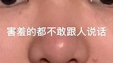 狂  人  日  记