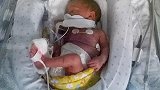 捷克一名孕妇脑死近4个月 竟然诞下健康女婴