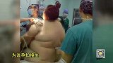 280斤孕妇生产  医院出动16名医务人员接生