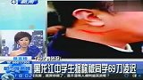 热点播报2012.3.2-黑龙江一中学生据称被同学69刀凌迟