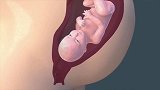 临产前的十几分钟，胎宝宝在腹中干嘛看着心里暖暖的
