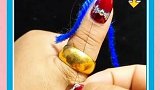 如果戒指戴久了摘不下来的，可以使用这个方法