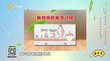 肠息肉有癌变的风险吗？