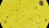 爱吃橘子的朋友注意了，橘子放大800倍，看了之后会避而远之