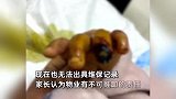 2岁男童小区玩滑梯致手指断裂截肢，家长：这隐患物业半年没修