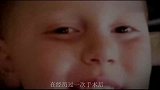 女儿患恶性肿瘤，在头颅上留下一个疤痕，然而爸爸的做法令人感动