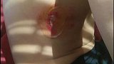 暴力犯规！安徽桂冠门将热身赛飞踹北理工球员 受伤图片惨不忍睹