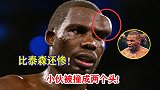 不愧是铁头功大师！不仅整惨泰森，此战直接把对手撞成“两个头”