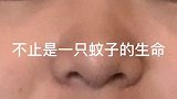 你还记得最近谁亲过你吗？是不是只有蚊子？