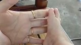 住院几天回来，就发现了两次