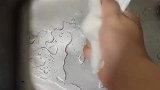 大兄弟，你是第一个敢这么做的，医院床位紧张吗