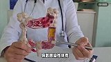 女子一顿烧烤吃进ICU：高烧40℃，感染性休克且多脏器功能衰竭